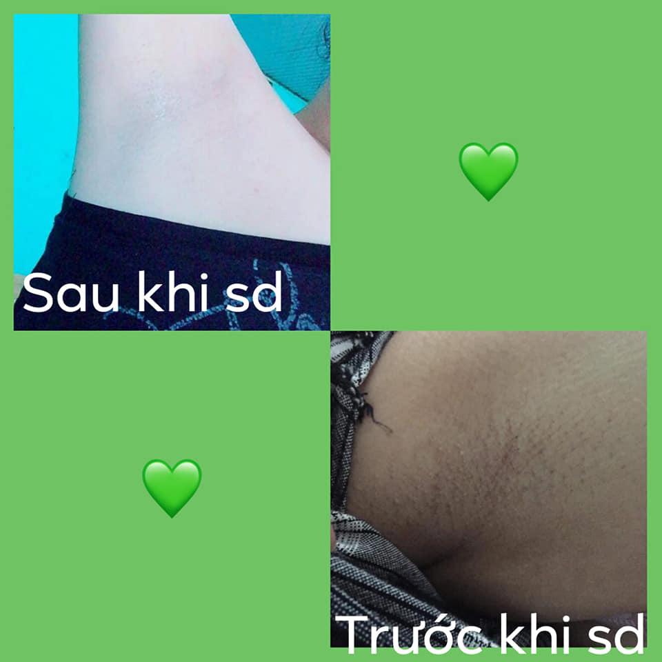 trị thâm pmt-serum trị thâm phúc minh tâm