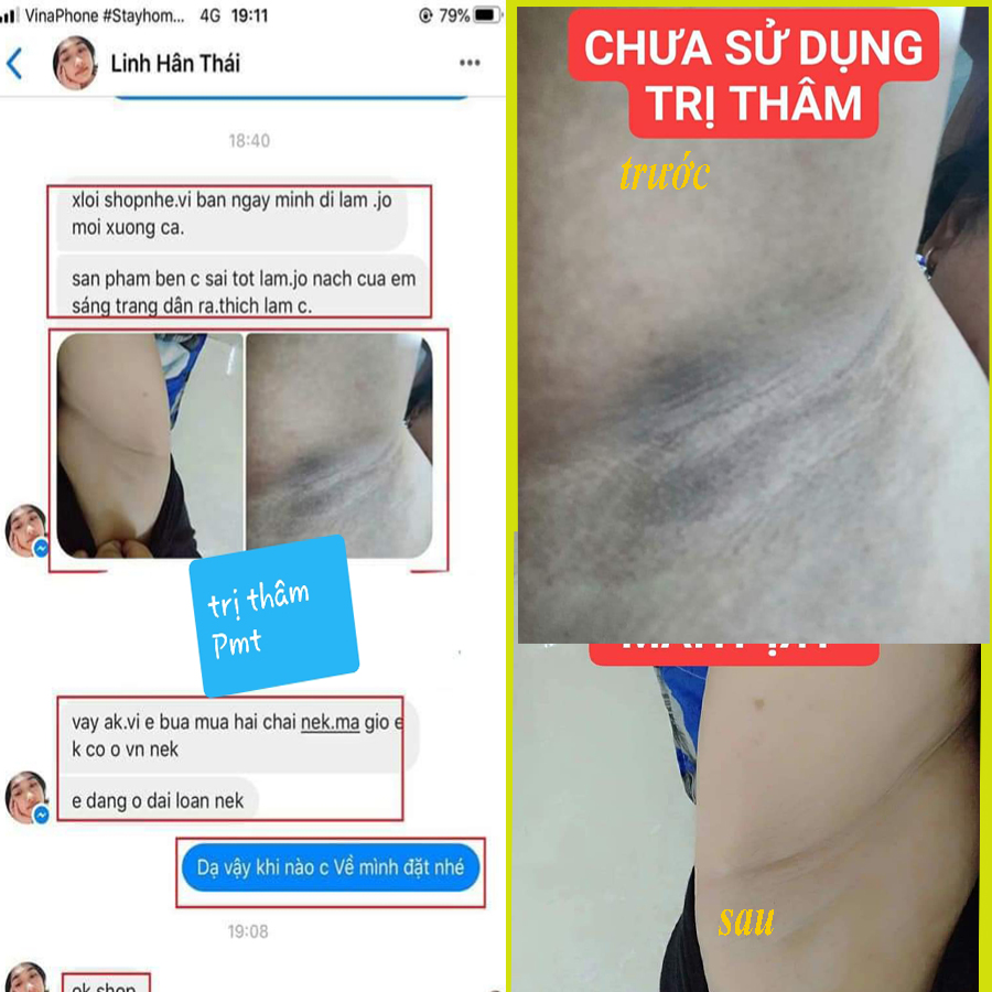 serum trị thâm phúc minh tâm trị thâm nách