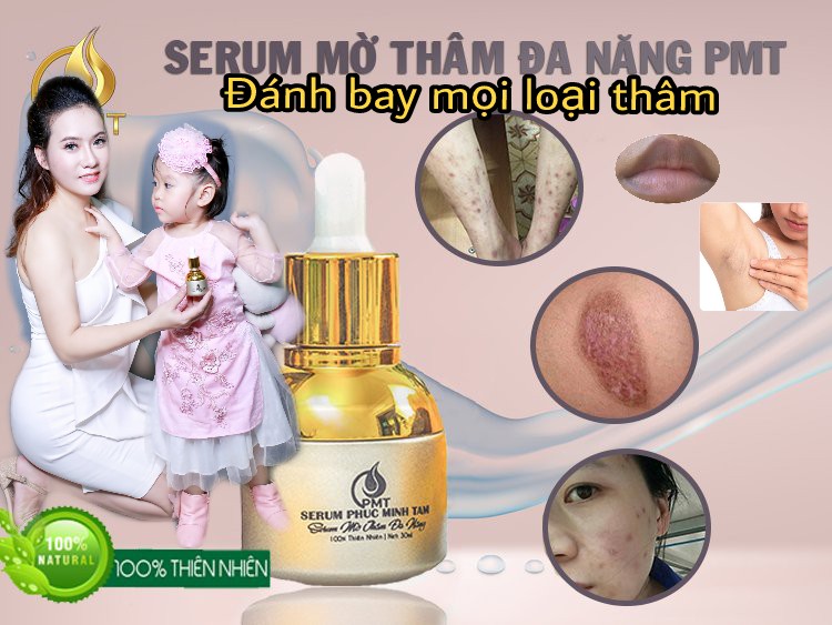 trị thâm pmt-serum phúc minh tâm