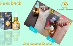 serum trị thâm pmt phúc minh tâm