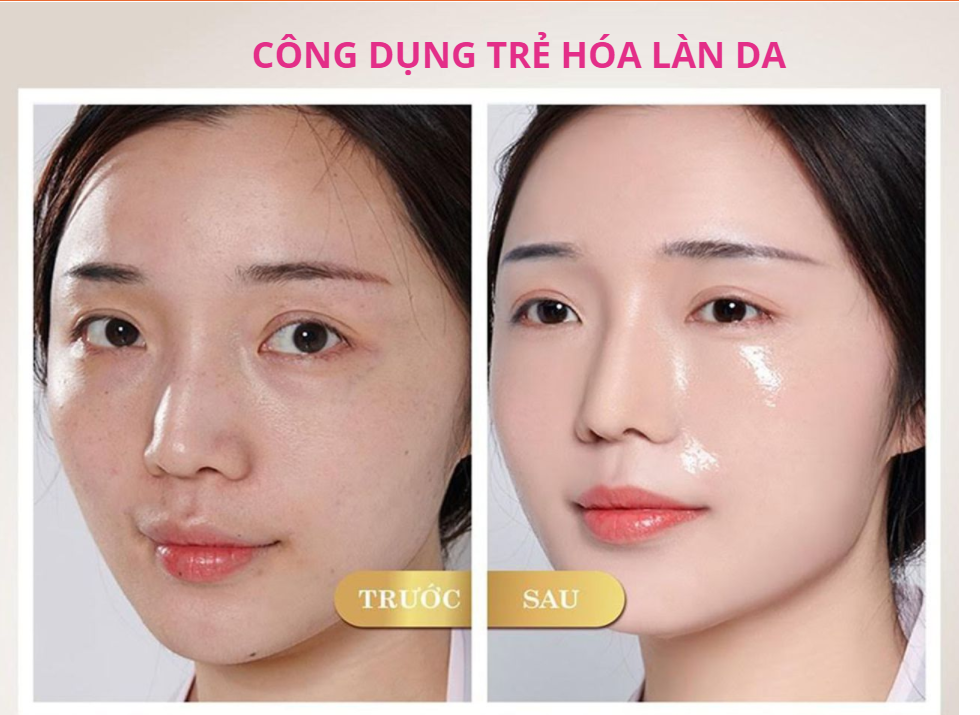 collagen hiệu quả nhất hiện nay, collagen x5 nhật bản, nước collagen yến sào shido