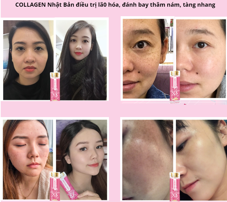 feedback review khách dùng collagen x5 nước collagen yến sào shido