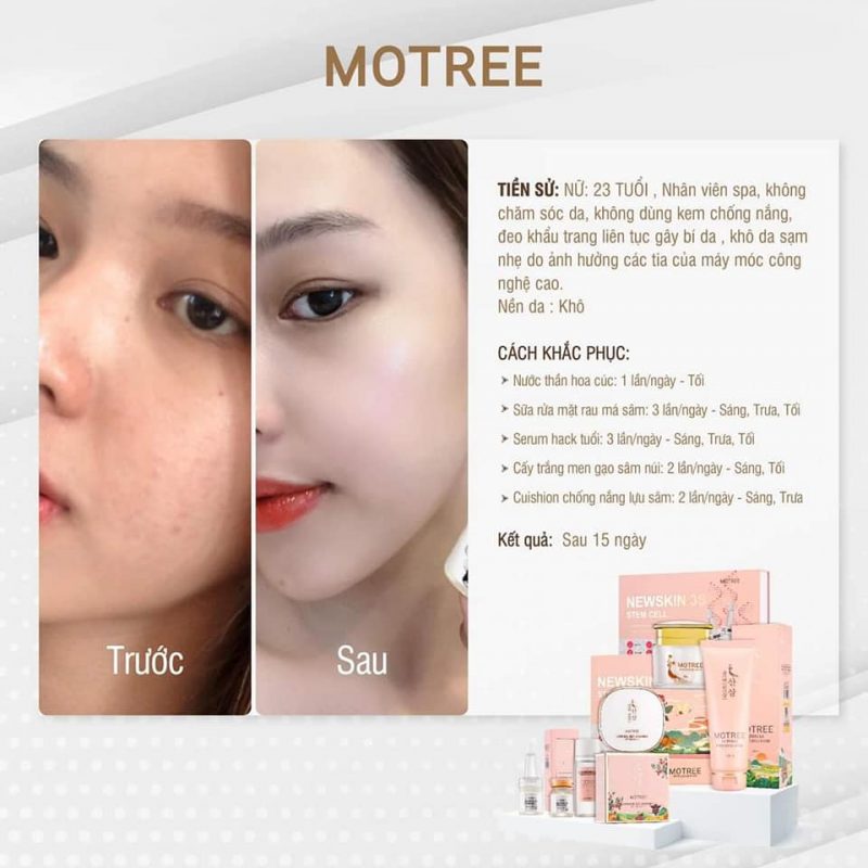 Kem dưỡng trắng da men gạo motree