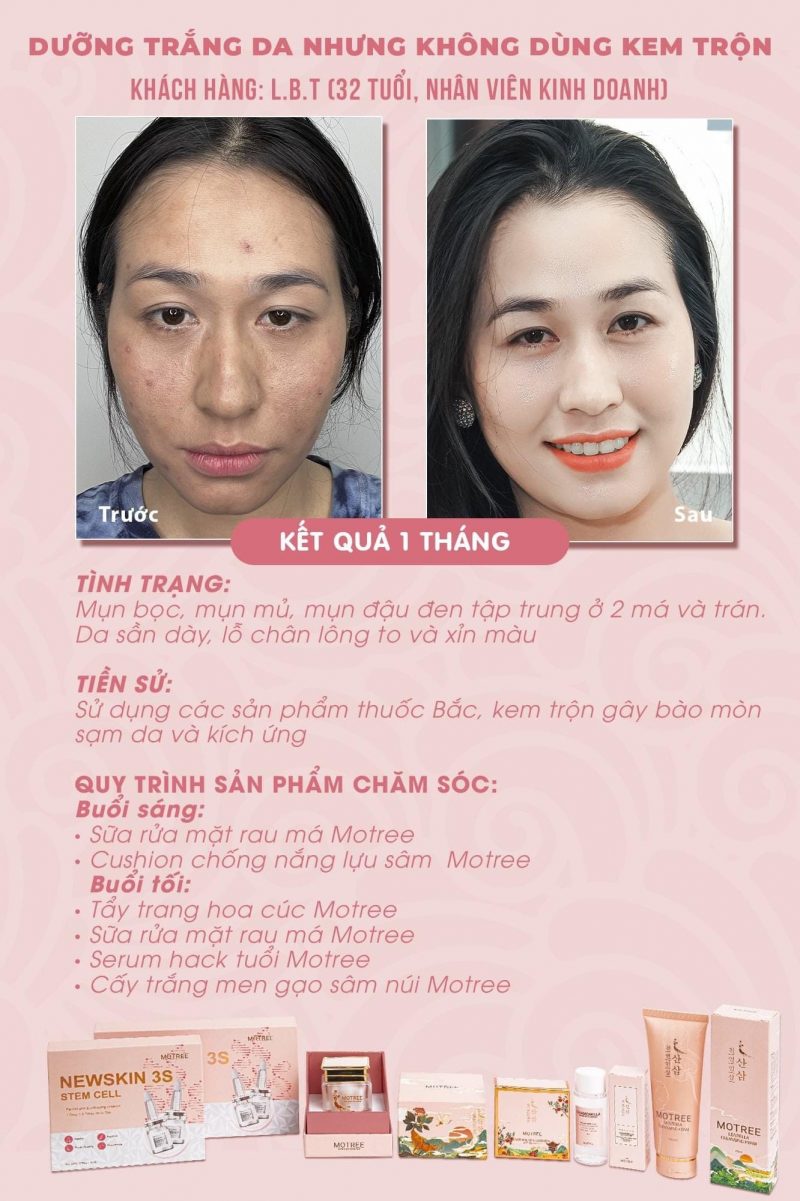 mỹ phẩm motree-kem dưỡng trắng da men gạo sâm núi motree