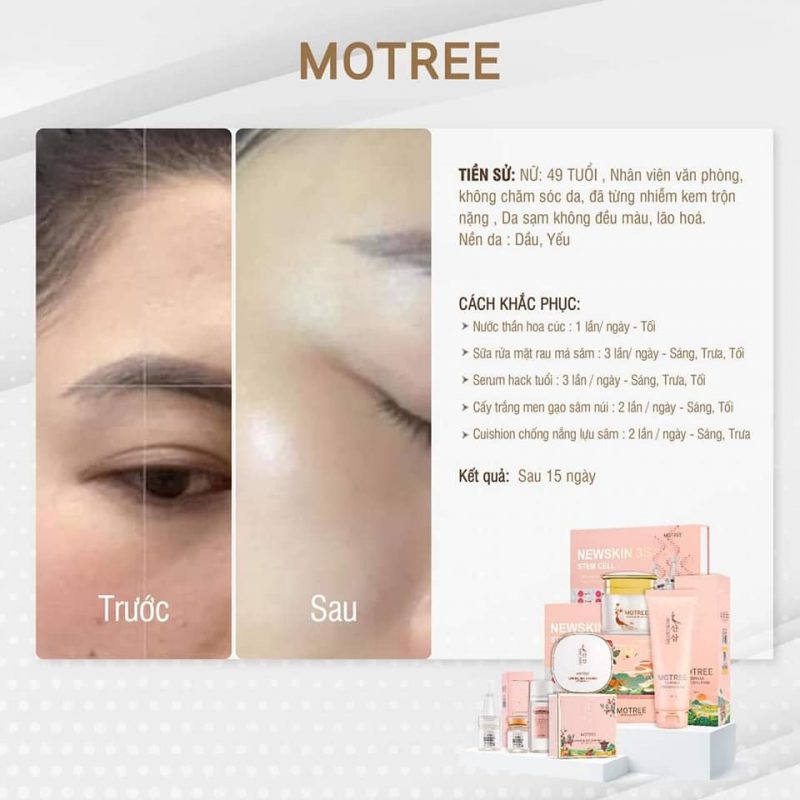 mỹ phẩm motree-kem dưỡng trắng da men gạo sâm núi motree